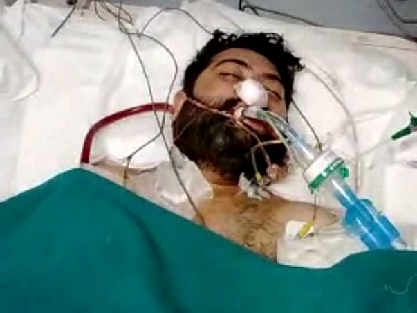 LUNG TRANSPLANT THE ONLY RAY OF HOPE FOR TARUN
