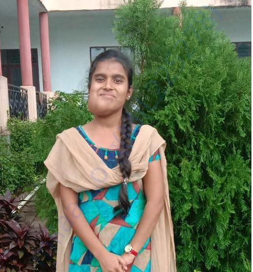 After diagnosis of fbrousdis placea disease