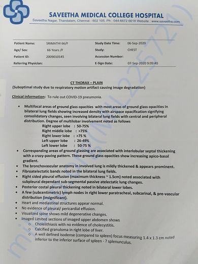 Admission date to ICU