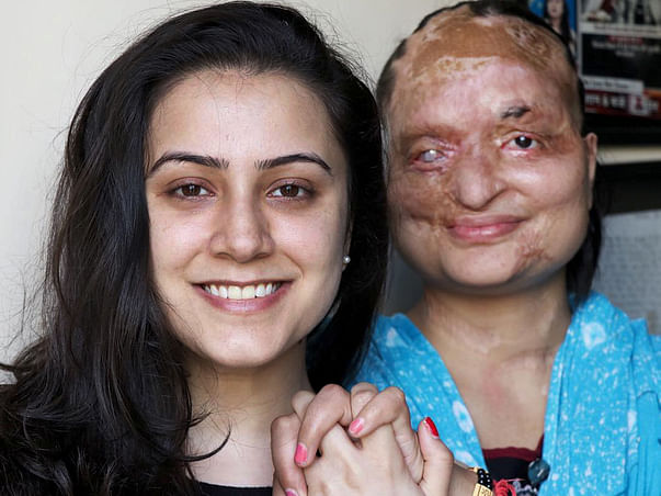 Help Make Love Not Scars Empower Acid Attack Survivors