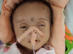 Help Ayansh For Open Heart Surgery