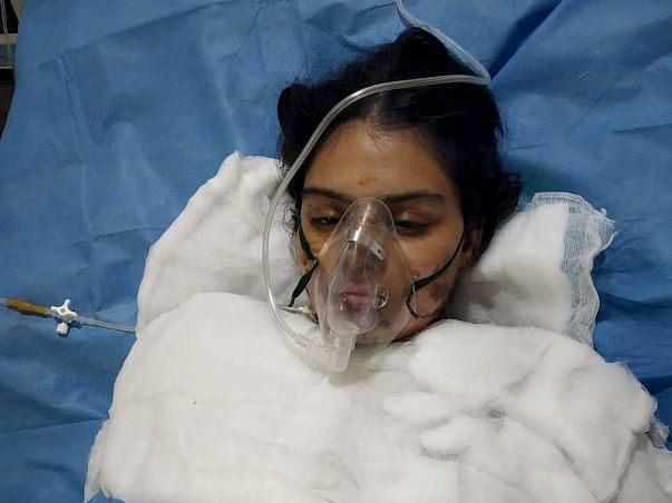 Support Tadikonda Bindu Susmitha Recover from Accidental Burns