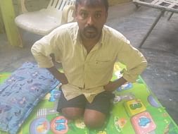 Nagaraju Needs Your Urgent Support For Artificial Limb And Livelihood