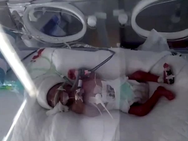 Support my niece...a preterm baby fighting for her life.