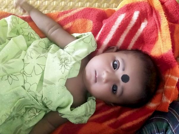 3 MONTHS BABY NEEDS YOUR HELP TO SURVIVE AFTER OPEN HEART SURGERY