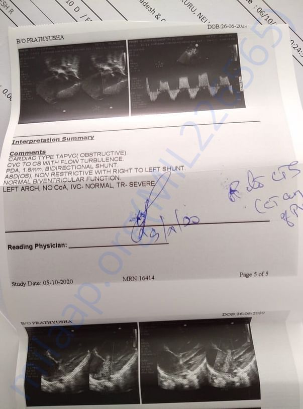HEART SCAN OR CARDIACC INTERPRETATION REPORT