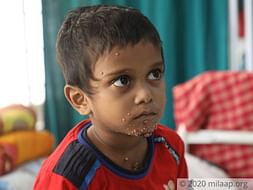 Support Ziynur fight/recover from Acute lymphoblastic leukemia (all)