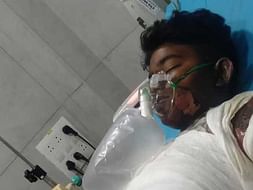 Help My Nephew Shyam Sundar Fight Electric Burn Injury