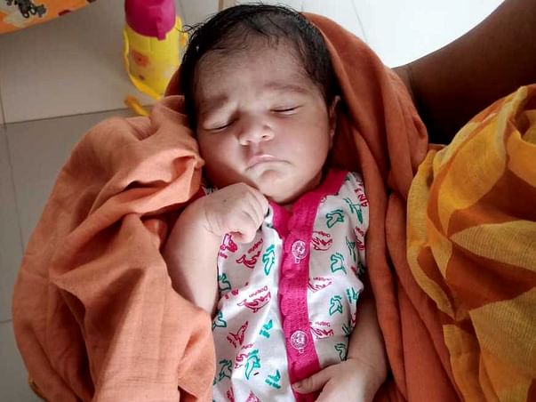 Baby is completely recovered and discharged. Thank you all