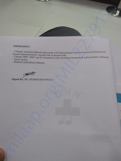 CT scan 2