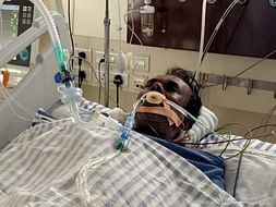 Support Bogegowda Recover From Gastric Perforation