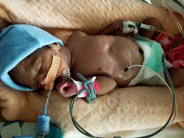 Kindly Help My 36 Days baby from NEC/PDA/Septic Shock *Urgent*