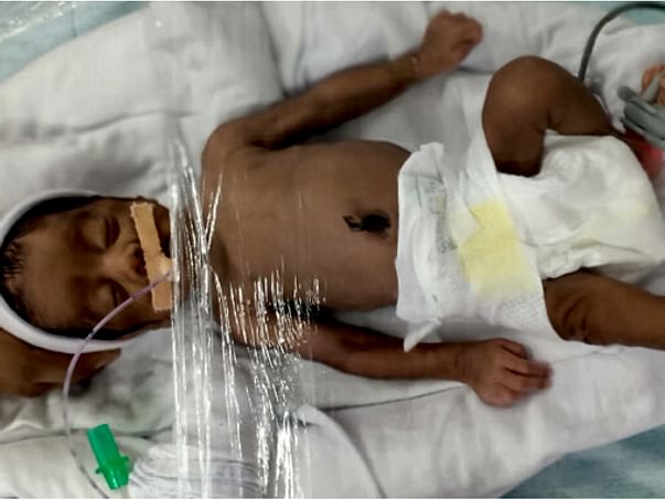 4-month-old Ansiya Will Not Survive Without Ventilator Support .
