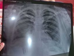 My Friend Bhoomika N Is Struggling With Bladder Infection, Help Her