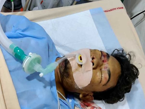 Support Srujan and save his life