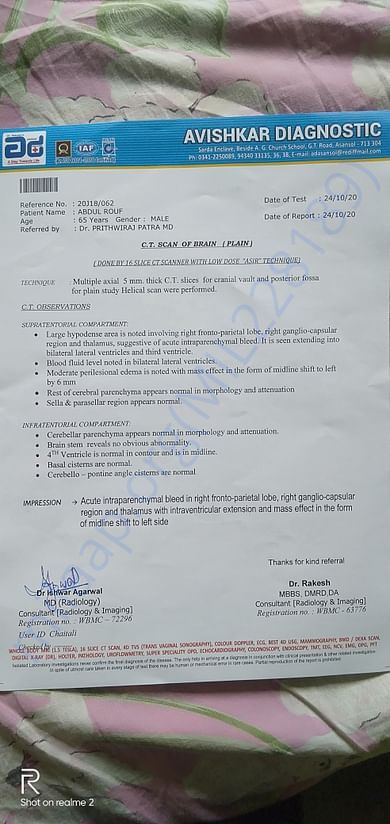 Ct scan report