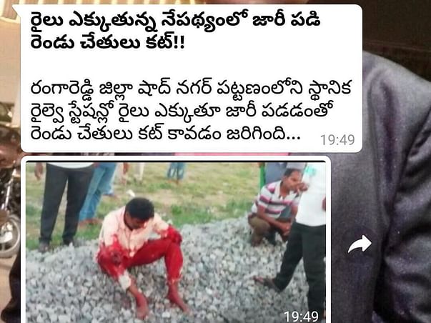 Shaboddin As He Lost His 2 Hands, Transplant Need Help