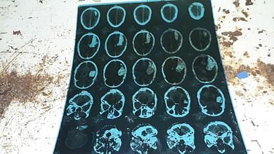 CT Brain Film