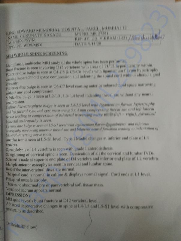 MRI report