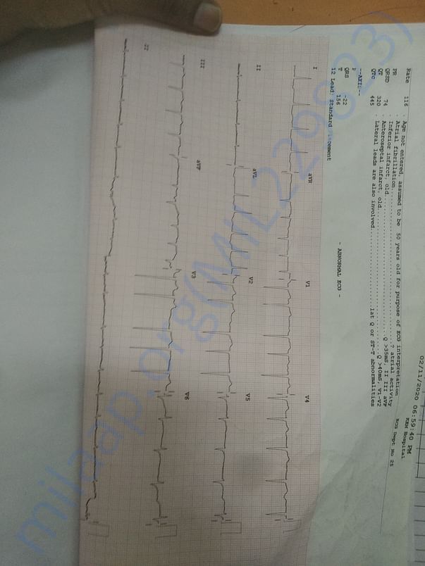 ECG report