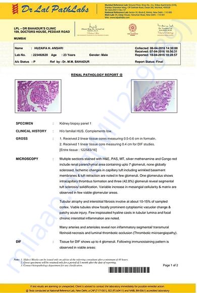 Kidney biopsy for ahus