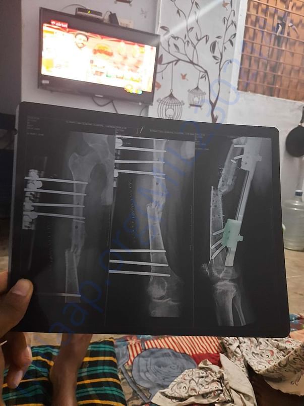 X-RAY