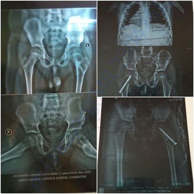 X ray