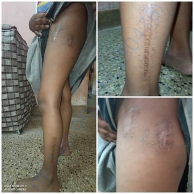 Mohamed Usman's leg
