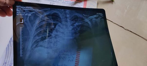 x ray report