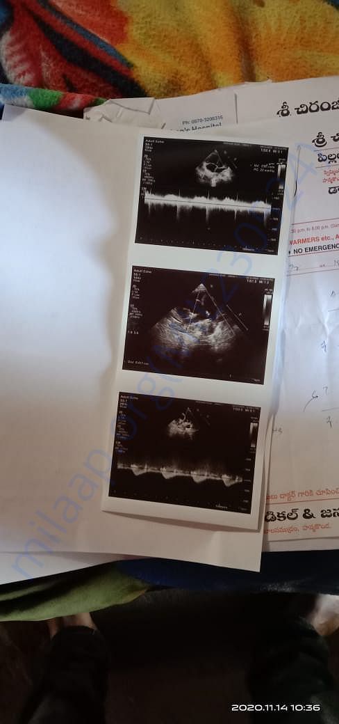 scan