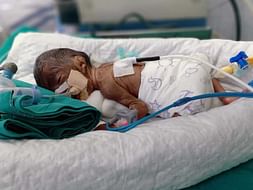 Support Kirtis Baby Recover From Premature Delivery Complications