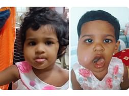 Help Aysha Fidha Fight Tumor