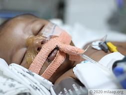 Help My 3 Months Baby Suffering From Diaphragmatic Breathing