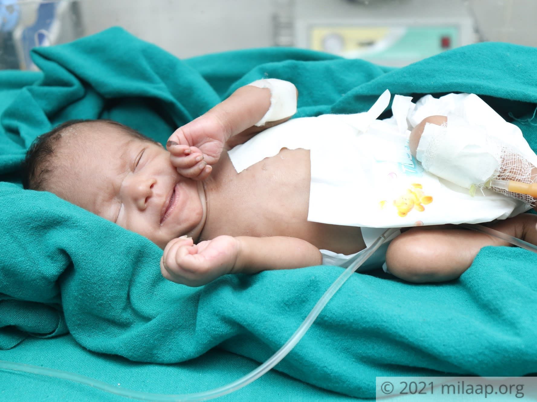 Premature Baby Boy Is Struggling In NICU To Survive, Only You Can Help
