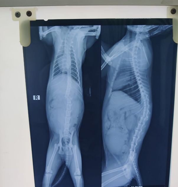 Baby K's Xray