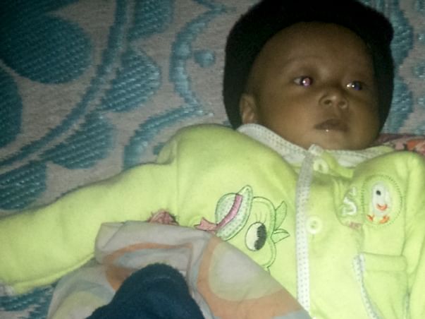 I am fundraising to help 5 month old child suffering from a serious heart ailment get immediate surgery. Please join my campaign.