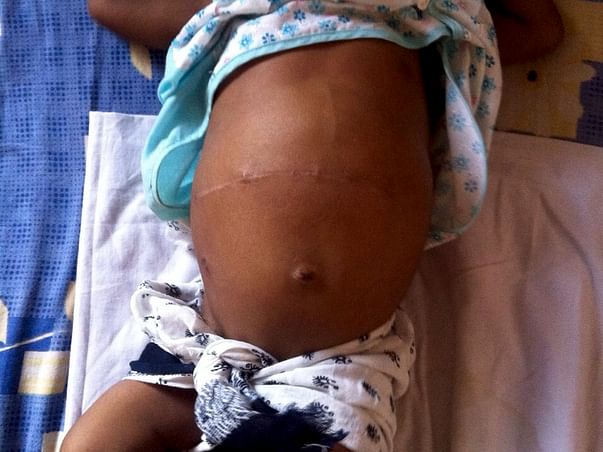 I am fundraising to buy book "Misha learns about money on Amazon to fund Baby Jhiya's treatment
