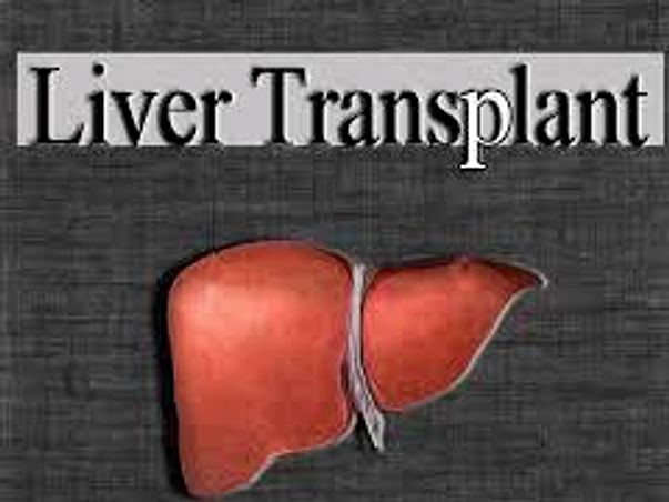 I am fundraising to husband's Liver Transplant