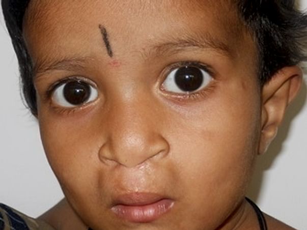 We are fundraising to provide free surgical treatment for underprivileged patients