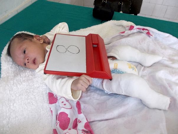 I am fundraising to help treat clubfoot in babies