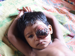 I am fundraising to treat the baby Manik Dhar who is battling with cancer