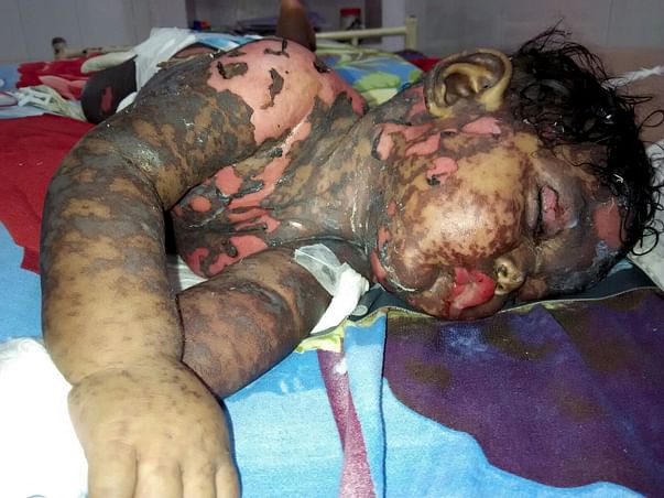 I am fundraising to help to save this 7 months old baby