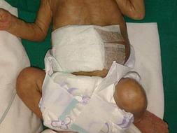 Help this Uber partner save his 7 month old pre-mature baby