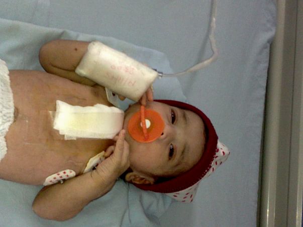 Help for an open heart surgery costs for a 4 days old baby