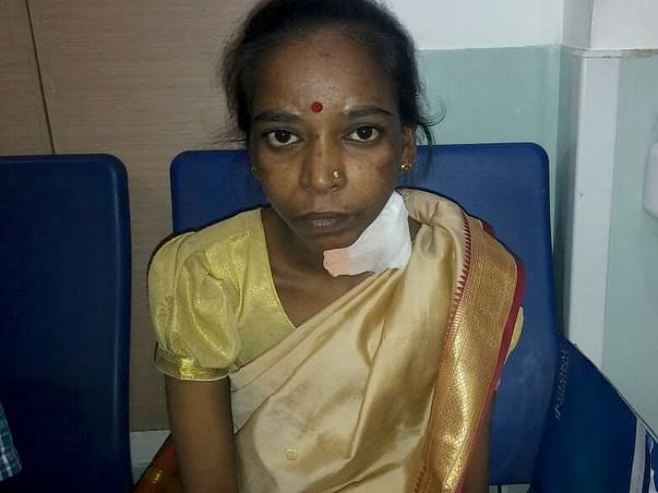 Help Sucheta Undergo A Kidney Transplant