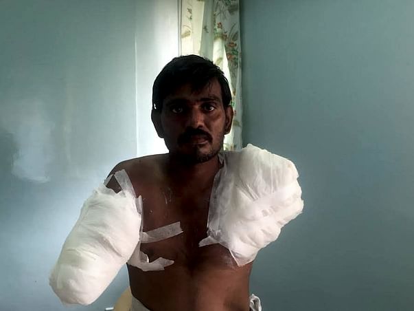 Help Rama Subahiah to undergo treatment for his burnt hands.