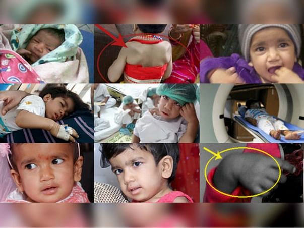 Help My Daughter Live #HelpSaveAvishi