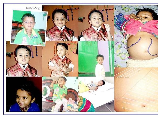 Help Ayush Fight A Rare Genetic Disorder - Gaucher Type 3