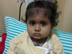 Baby Manvitha Needs Your Support To Fight Blood Cancer