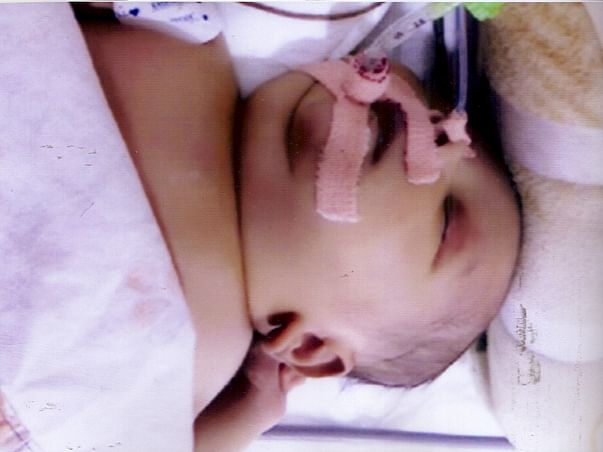 Help baby of Ramya get treatment for Sepsis
